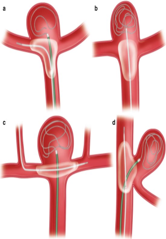 Interventional Radiology Equipment